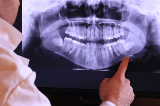 Best Emergency Treatment for Toothache in Washington, IL